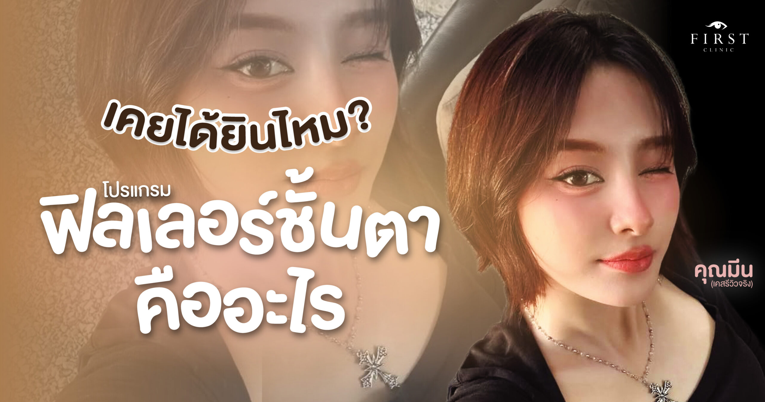 รีวิวฟิลเลอร์ชั้นตา