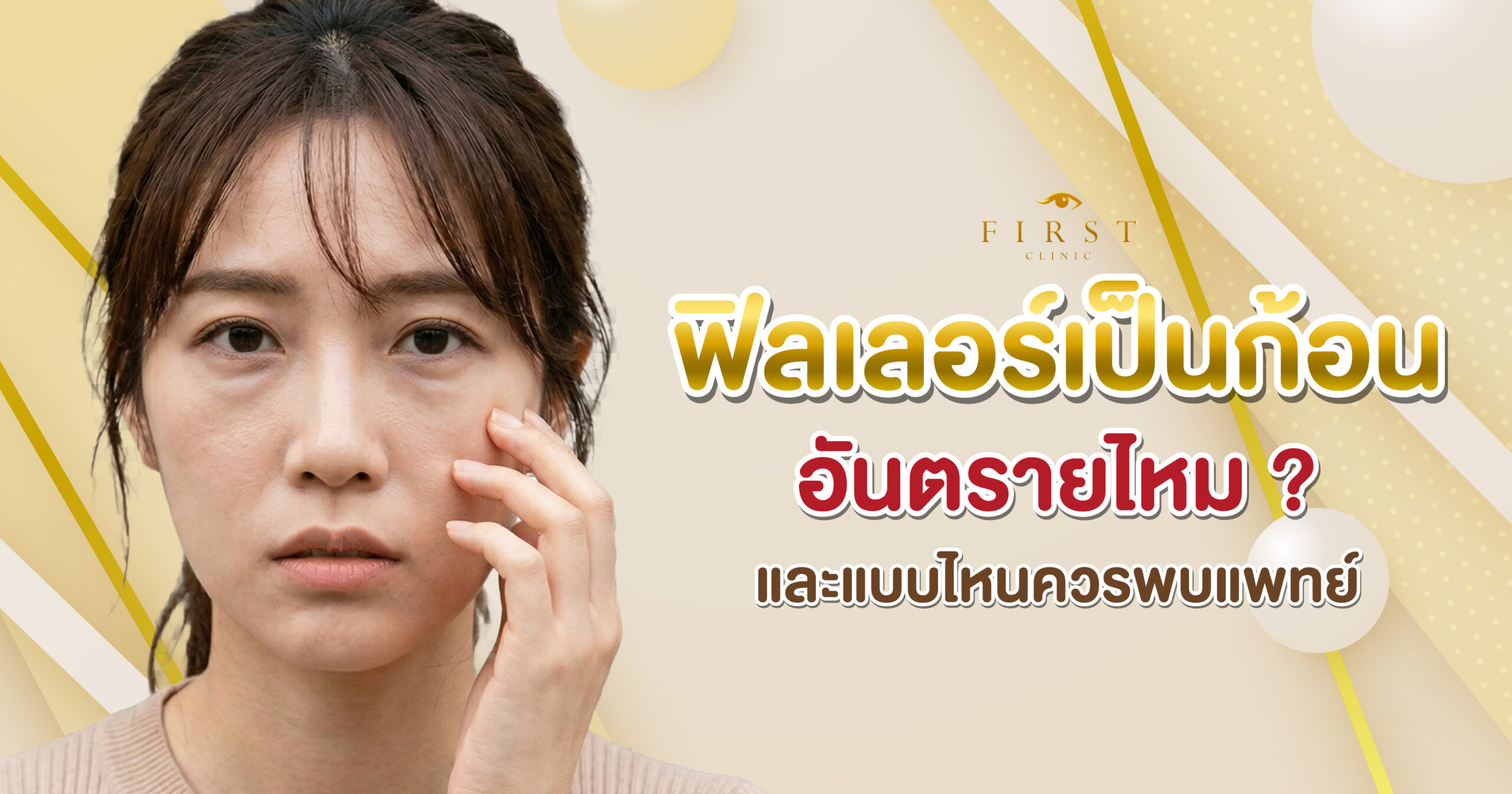 ฟิลเลอร์เป็นก้อนแก้ยังไง